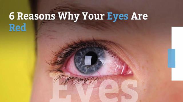 6 Reasons Your Eyes Are Red 7040