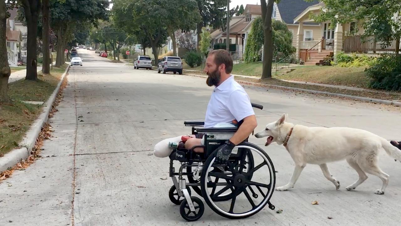 Man Works To Recover After Losing Both Legs