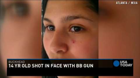 bb gun shot in face